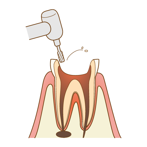 清掃・洗浄・消毒